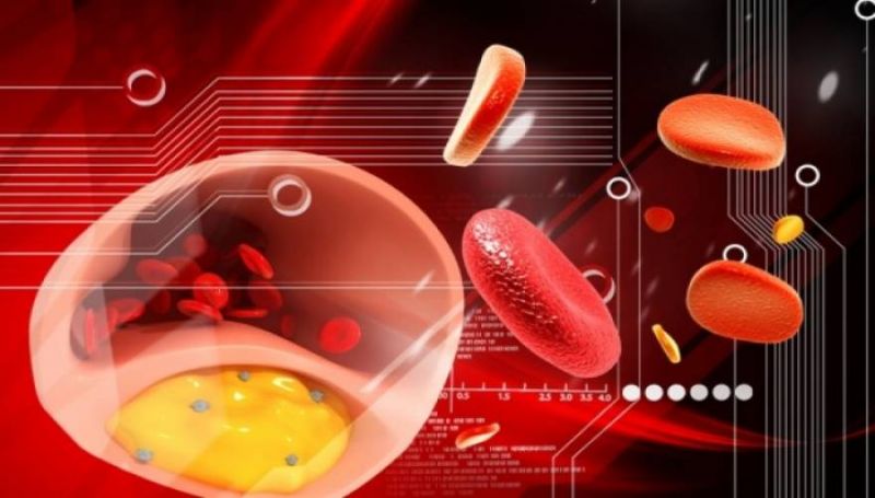 Τα τέσσερα σωτήρια μέτρα πρόληψης της θρόμβωσης